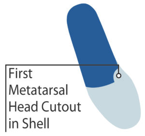 First metatarsal head cutout in shell