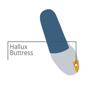 hallux buttress