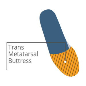 trans metatarsal buttress