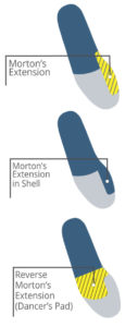 Morton’s Extensions