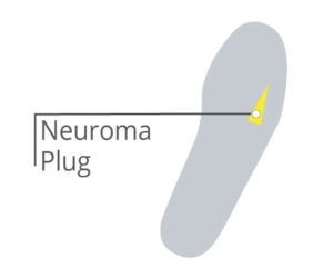 Neuroma Plug