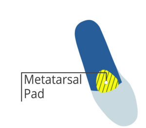 metatarsal pad