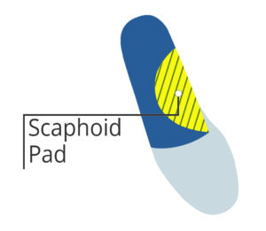scaphoid pad